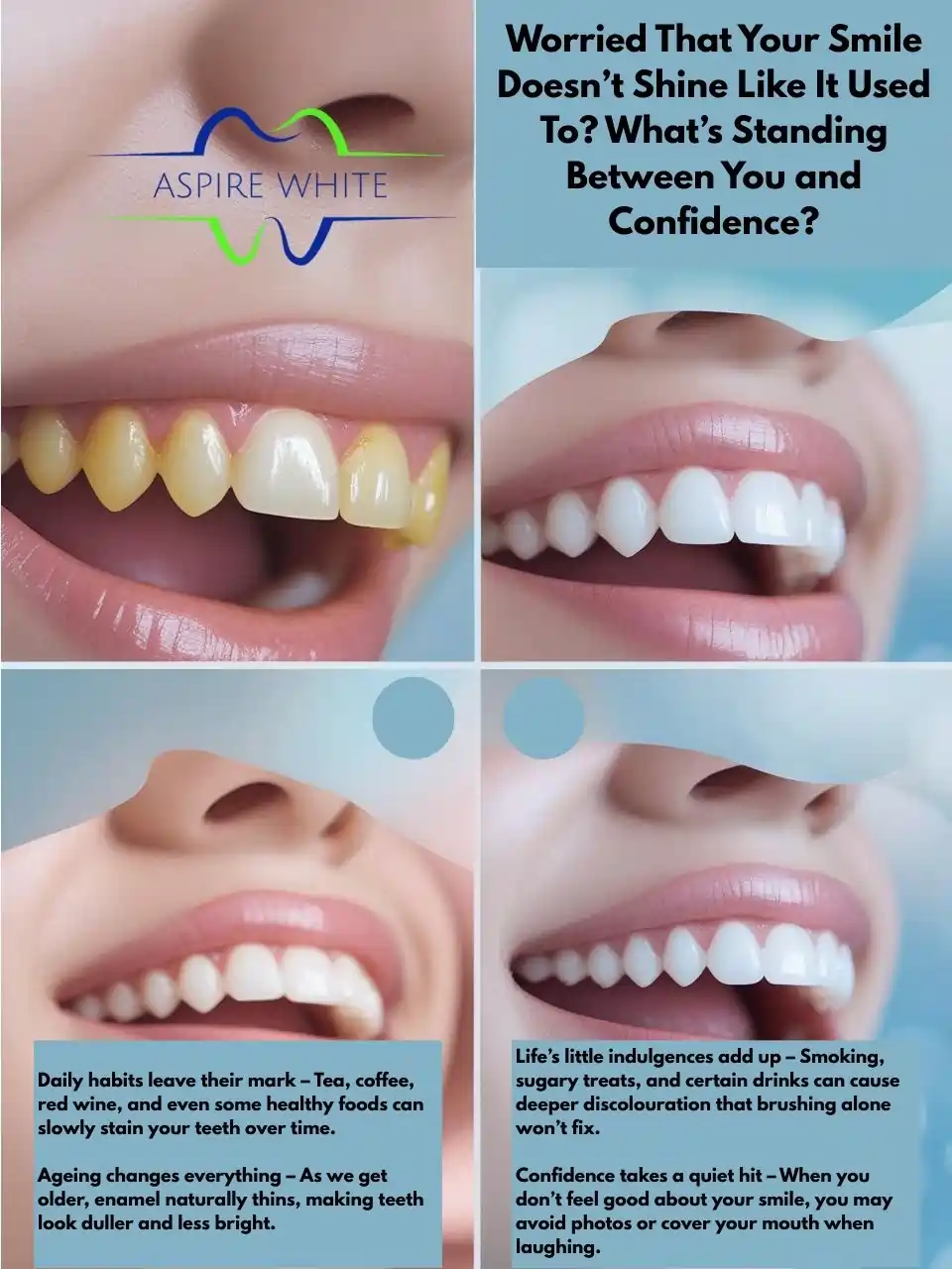Worried That Your Smile Doesn’t Shine Like It Used To What’s Standing Between You and Confidence Croydon